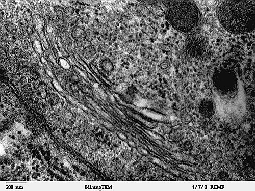 Transmission electron microscope image of thin section cut through an area of mammalian lung tissue. Image shows golgi in the cytoplasm of a macrophage in the alveolus. Golgi is a structure involved in protein transport in the cytoplasm of the cell.