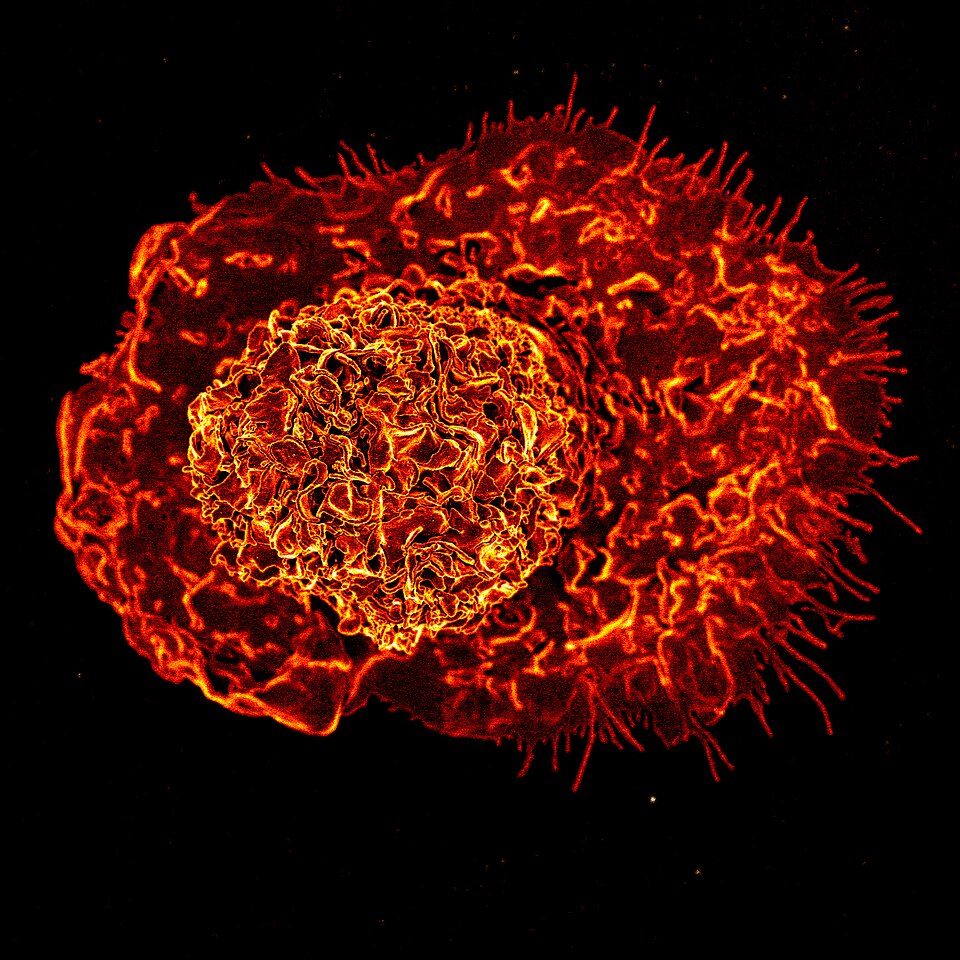 Scanning electron micrograph of a macrophage. The cell surface shows irregular ruffles and pseudopodial extensions characteristic of an activated macrophage.