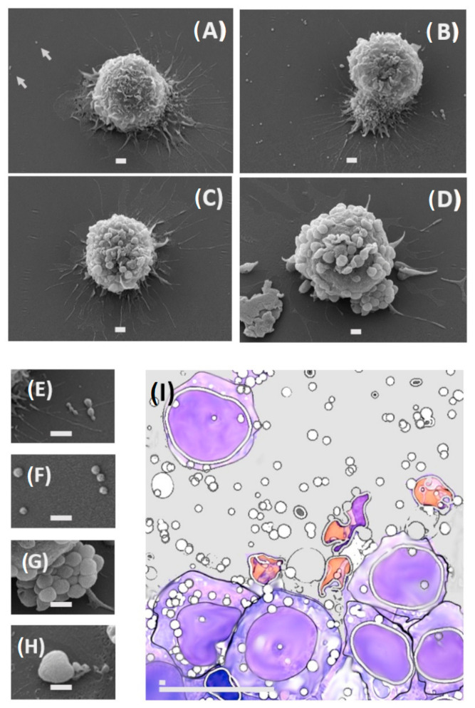 Scanning electron microscopy of J774A.1 cells secreting PEVs. The J774A.1 cell line was stimulated with a small amount of E. coli SBMF stabilized with FN, distributed as a substrate on the cell culture surface, for 2 h of interaction. ( A ) The results occasionally show cells with a normal or unstimulated appearance; this result suggests that those cells that did not come into contact with the substrate showed fewer PEVs, indicated by arrows. ( B - D ) Cells that came into contact with the substrate generally changed their morphology and exhibited PEVs. ( E - H ) Stimulated J774A.1 PEVs. Scale bar ( A - H ) 1 um. ( I ) Schematic image illustrates a biopsy of a submandibular lymph node, erased by metastatic histiocytic sarcoma, large scale 20 um and short scale 1 um, based on Purzycka et al. 2020.