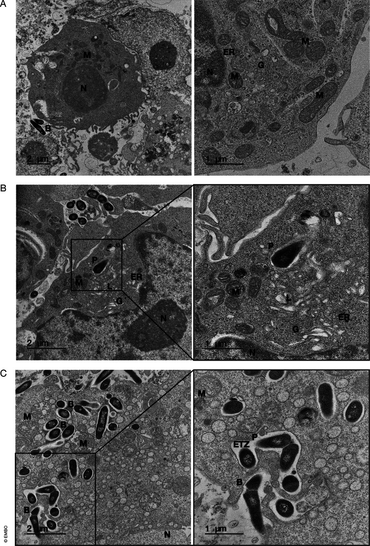 Ultrastructural analysis of M. abscessus infection in THP-1 cells. Transmission electron microscopy (TEM) analysis of THP-1 cells differentiated with PMA and infected with M. abscessus smooth morphotype (S form) at a multiplicity of infection of 10:1. (A) Uninfected THP-1 cell showing a few extracellular bacilli. (B) At 4 h post-infection, M. abscessus S bacilli are enclosed within phagosomes characterized by tightly apposed phagosomal membranes and close association with mitochondria. (C) At 24 h post-infection, phagosomal membranes occasionally display irregularities or partial breaks, suggesting potential phagosome-cytosol communication. Nevertheless, most bacilli remain enclosed within phagosomal compartments, and some exhibit signs of intracellular division. An electron-translucent zone (ETZ), characteristic of the smooth morphotype and associated with surface glycopeptidolipids (GPLs), is observed surrounding the bacilli.